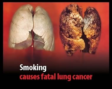 lungcancer.jpg